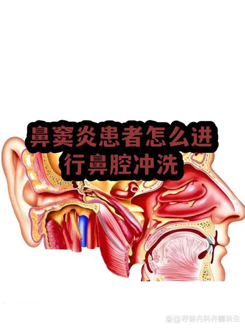 北京鼻炎：冬日里的隐形烦恼与应对之道