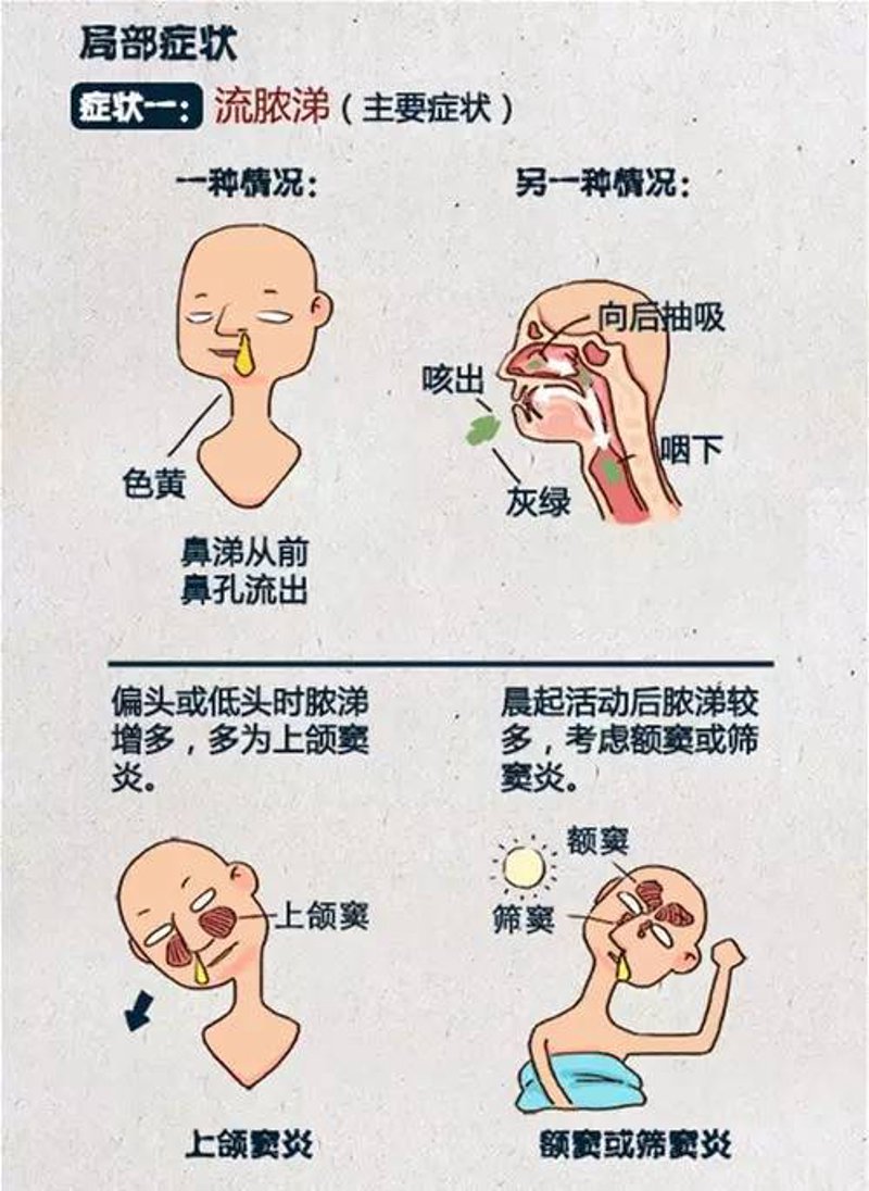 鼻炎护理新知：远离恼人病痛