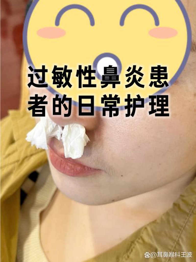 鼻炎护理小贴士：守护你呼吸顺畅的健康之道